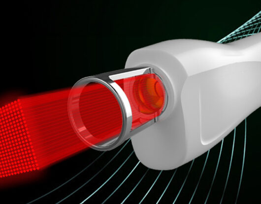 laser tulowy Łomża